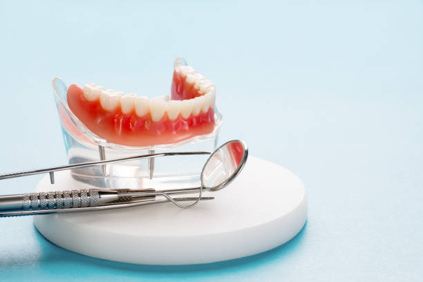 Dental Inlays and Onlays in Oberlin, LA