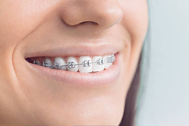 Best Preventive Dentistry  in Oberlin, LA